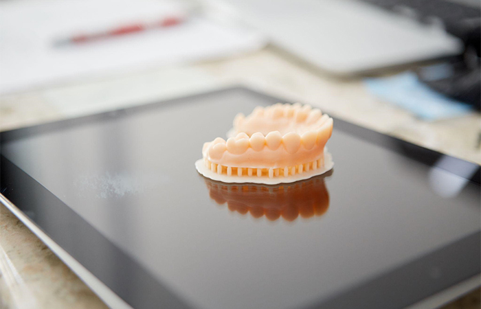 個人トレーの製作や型取り