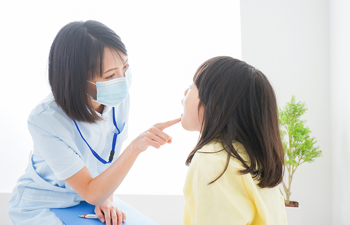 小児歯科で行うこと