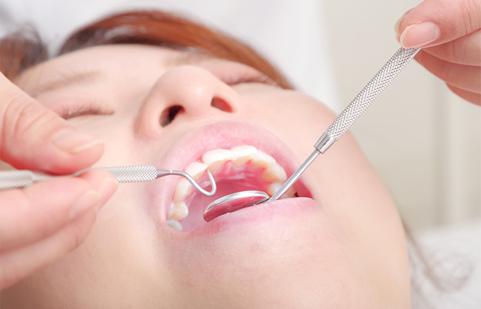 歯肉炎～軽度の歯周炎の治療