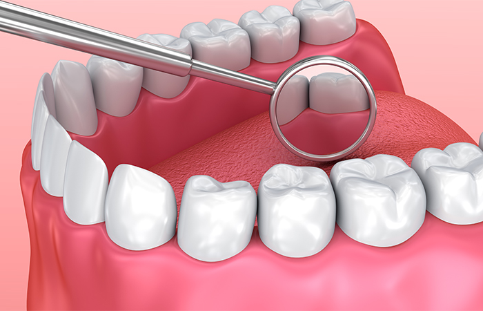 定期検診で行うこと